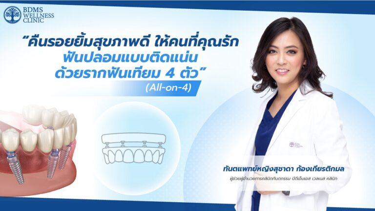 “รากฟันเทียม” All-on-4 ปลดล็อกปัญหาฟัน เติมเต็มความมั่นใจให้กับผู้สูงวัย