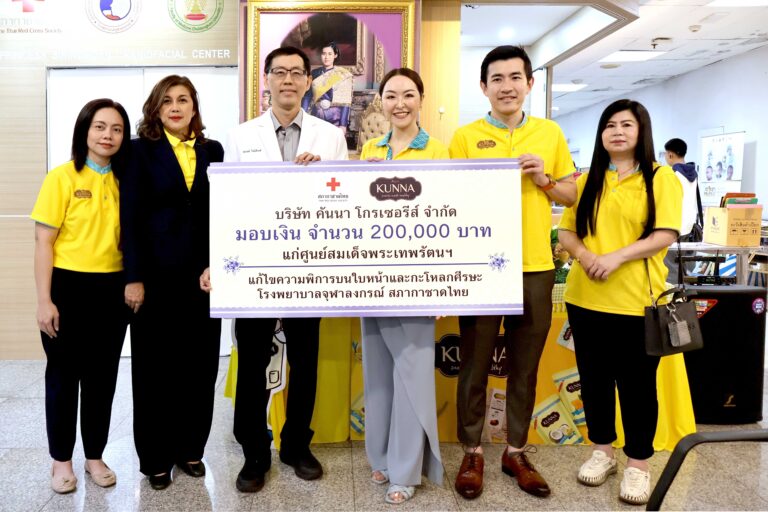 ‘คันนา’ มอบทุน 200,000 บาท และขนมเพื่อสุขภาพ “คันนา” แก่ ศูนย์สมเด็จพระเทพรัตนฯ แก้ไขความพิการบนใบหน้าและกะโหลกศีรษะ โรงพยาบาลจุฬาลงกรณ์ สภากาชาดไทย